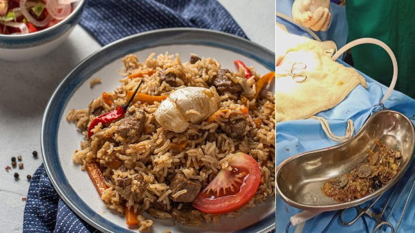 खाने से पहले निगले आभूषण