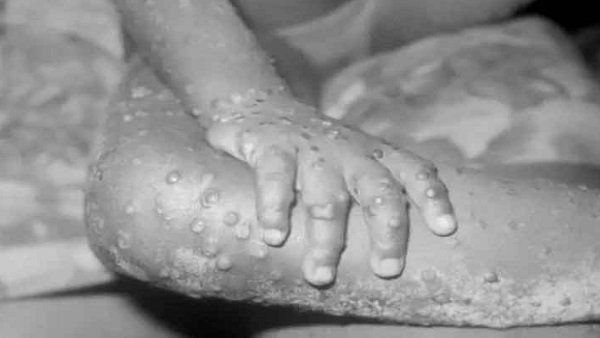 ब्रिटेन में मिला प.अफ्रीकी स्ट्रेन ब्रिटेन में मिला प.अफ्रीकी स्ट्रेन