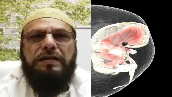 बच्चे के पेट के अंदर मिला भ्रूण