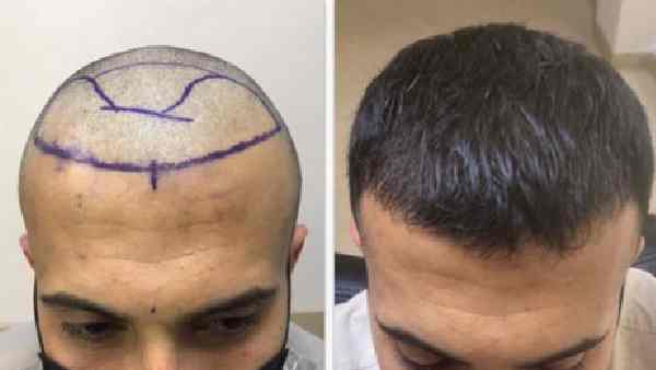 योग्य विशेषज्ञ ही करें या काम- दिल्ली हाई कोर्ट