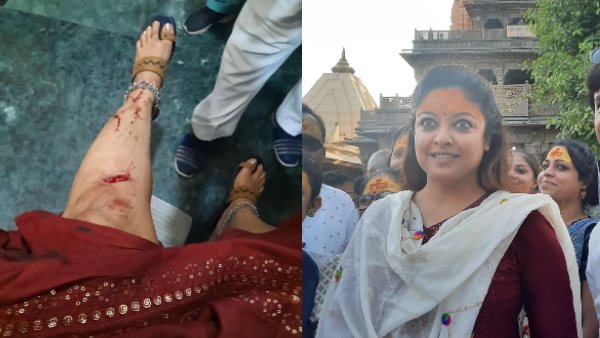 एक्ट्रेस के घुटने में लगा गहरा जख्म