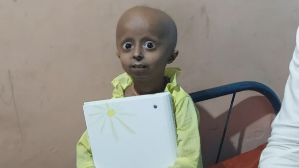 क्या है प्रोजेरिया बीमारी