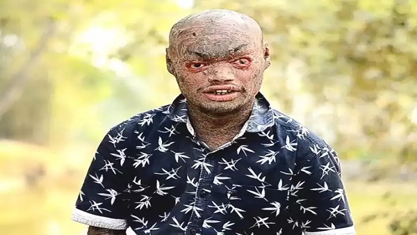  बिहार का स्नैक मैन