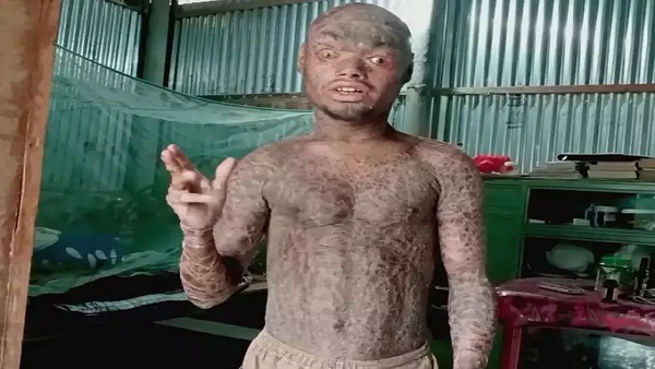  पढ़ाई छूटी, लेकिन नहीं टूटा हौंसला