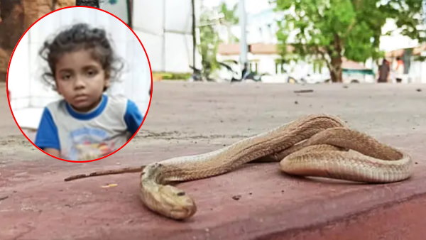कोबरा ने बच्चे के पैर में काटा
