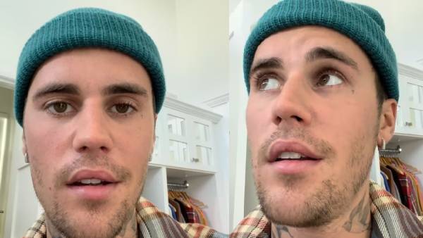 चेहरे का एक हिस्सा हिला पाना मुश्किल