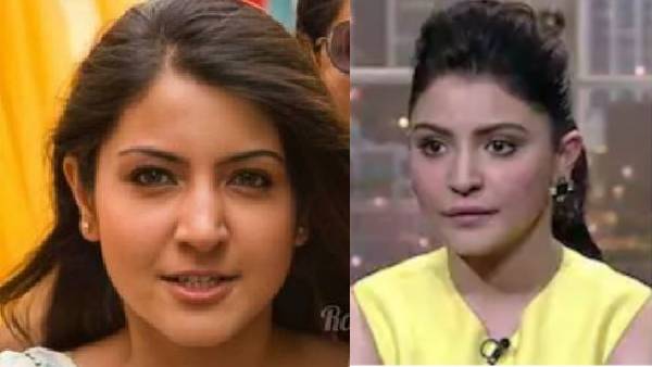 अनुष्का शर्मा