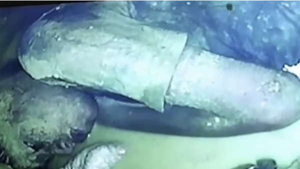 कलेक्टर ने राज खोलते कहा कि हम काफी चिंतित थे