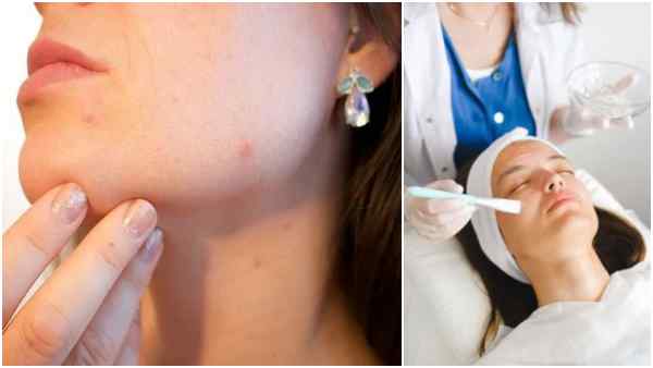 जामुन से त्वचा की सेहत में सुधार