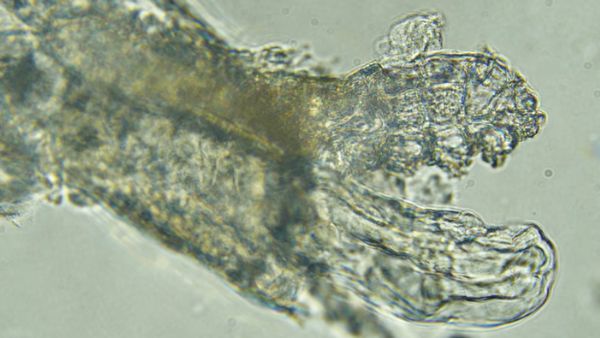 स्किन माइट्स की 48 हजार प्रजातियां