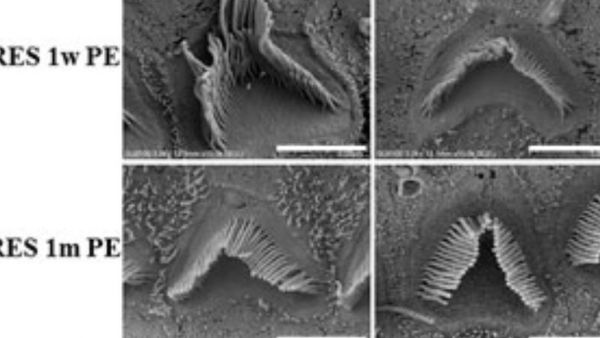 यमनाका कारक के साइड इफेक्ट
