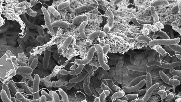 अलग-अलग इलाकों में फैला हैजा