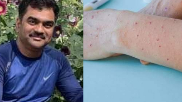 स्वास्थ्य आयुक्त द्वारा एडवाइजरी जारी स्वास्थ्य आयुक्त द्वारा एडवाइजरी जारी