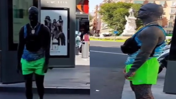 ब्लैक एलियन बनने के चक्‍कर में पूरे शरीर का किया ये हाल 