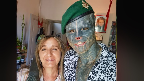 एंथोनी बोला- यह हर दिन एक लड़ाई है