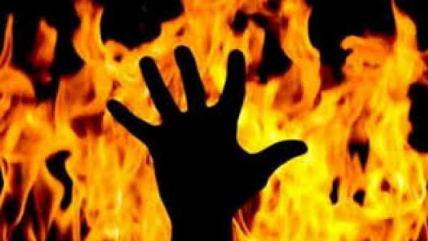 गंभीर रूप से झुलसे मालिक का चल रहा इलाज