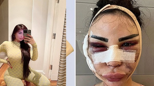 सामान्य शरीर में लौटने के लिए कराए कई ऑपरेशन