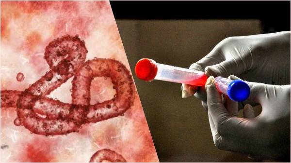 बीमारी के क्या हैं लक्षण, जानें