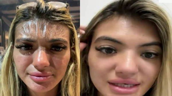 प्लास्टिक में बदलने लगी स्किन