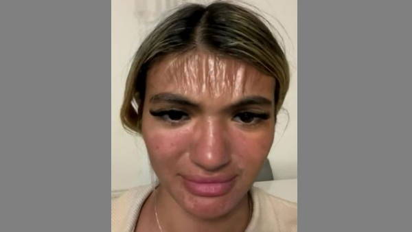 पूल में नहाकर धूप में लेटी महिला