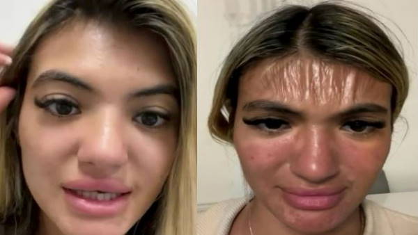 बताया कैसा हुआ दर्द