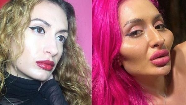 'चेहरा बिगाड़ने' का लेती है स्पेशल ट्रीटमेंट