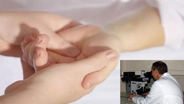 80 प्रतिशत तक बर्न केस में भी मिलेगा लाभ