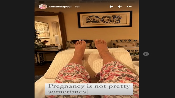 सोनम कपूर के पैरों में हुई सूजन