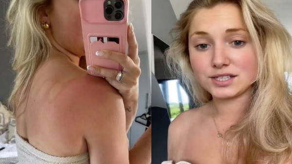 किसी ने दिन भर नहीं छुआ फिर भी आए निशान