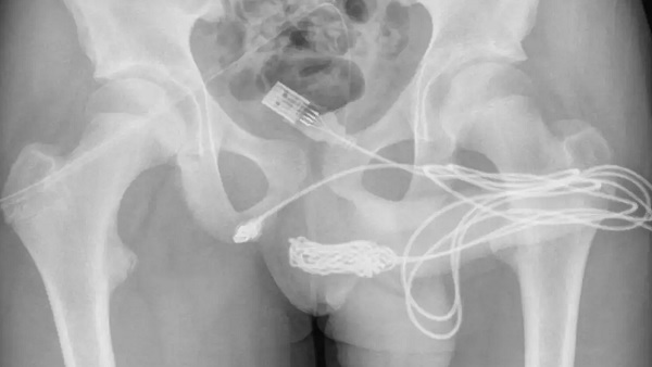 प्राइवेट पार्ट को नाप रहा था लड़का