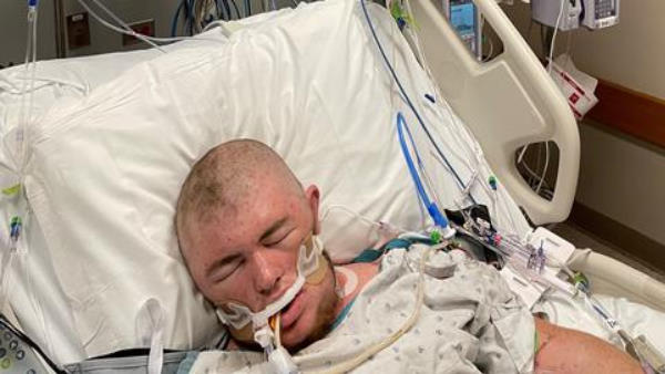 कोमा में चले गए थे ऑस्टिन