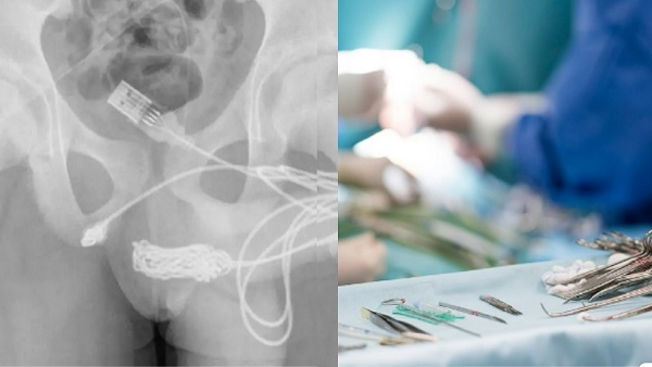 15 वर्षीय बच्चे का कारनामा