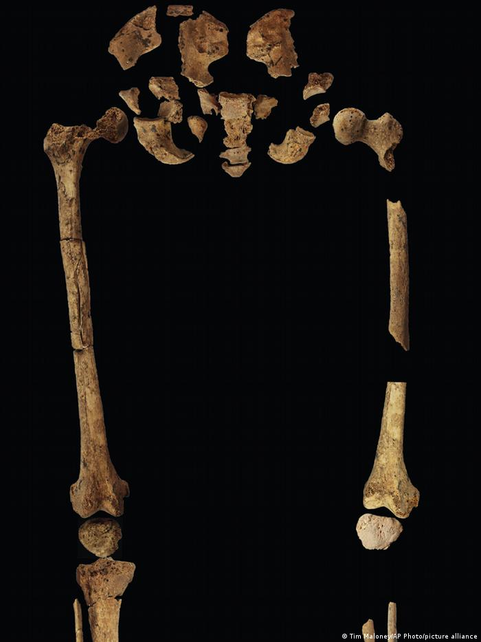 31 हजार साल पहले शल्य चिकित्सा के प्रमाण मिले