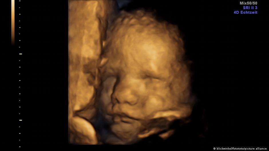 पत्तेदार सब्जियों के स्वाद से बच्चे रुआंसे हो जाते हैं