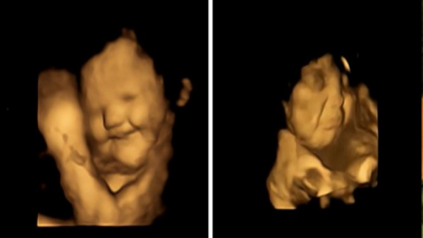 मां के ये खाते ही करते हैं स्‍माइल और ये खाने पर उन्‍हें आ जाता है रोना