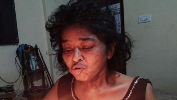 18 साल की बेटी ने छोड़ दी पढ़ाई, मां की सेवा के लिए