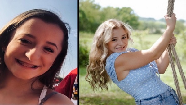 शार्क टूथ कहकर चिढ़ाते थे