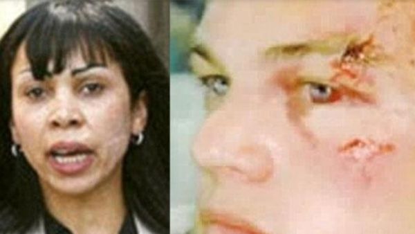 गर्लफ्रेंड ने सिर पर दे मारी थी बोतल 