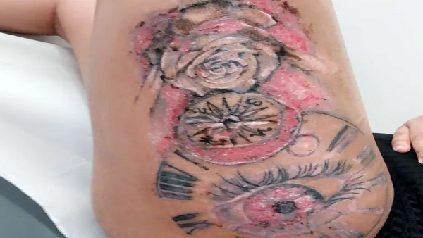 जाना पड़ा अस्पताल