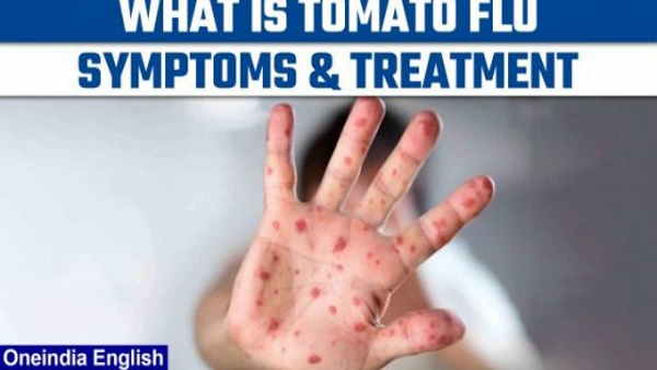 बच्चों में संक्रमण का ज्यादा खतरा