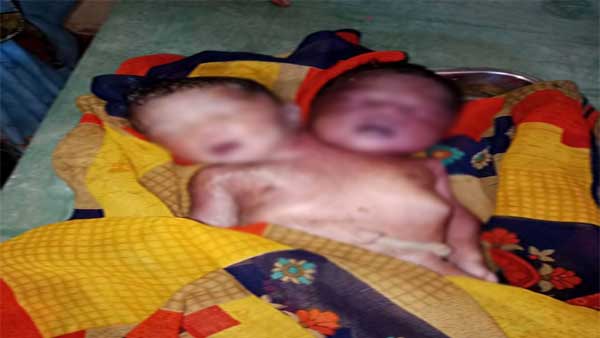 जन्म के बाद 15 मिनट ही जीवित रही बच्ची