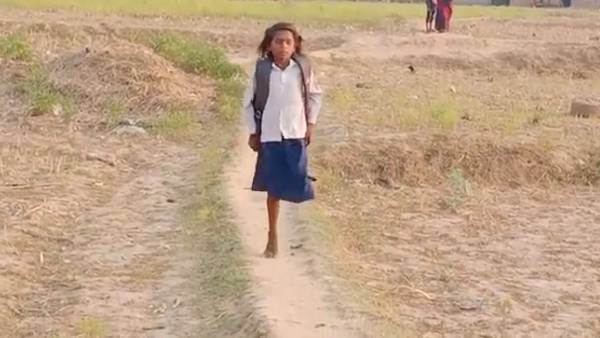 जिला प्रशान की पहल से लगा कृत्रिम पैर