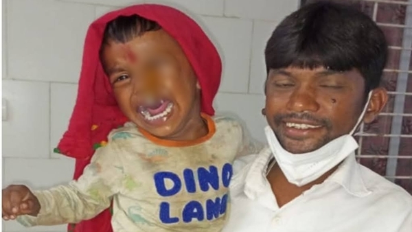 आंख में पेंचकस घुसा देख डाक्टर्स ने हाथ खड़े किए