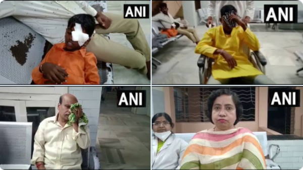 हैदराबाद में पटाखे जलाते समय बच्चे की आखों की रोशनी गई