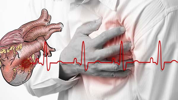 Heart Attack
