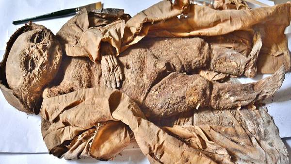 कुपोषण का हुआ शिकार