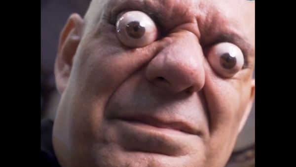 रेडर कंडीशन के साथ हुआ जन्म रेडर कंडीशन के साथ हुआ जन्म