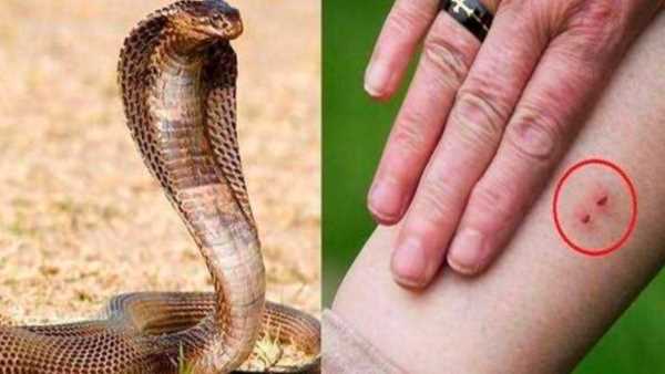 सर्पदंश से जिले में लगभग 630 लोगों की मौत