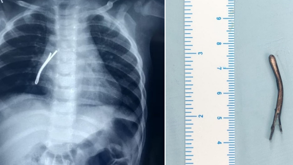 ENT सर्जनों की बनाई गई टीम ENT सर्जनों की बनाई गई टीम