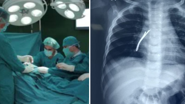 4 सेंटीमीटर हेयर पिन को निकाला बाहर 4 सेंटीमीटर हेयर पिन को निकाला बाहर